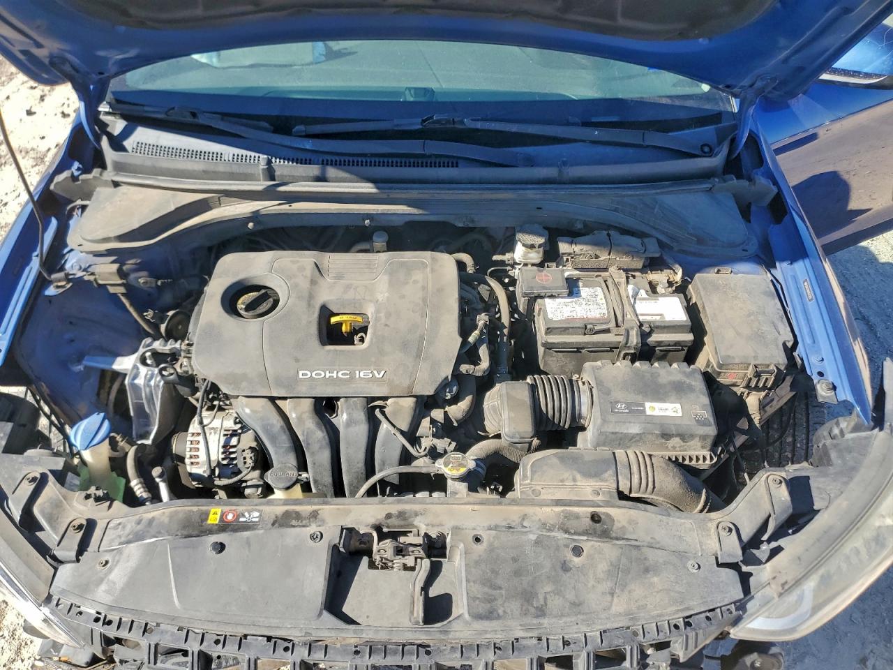 Hyundai ELANTRA Se Image 5